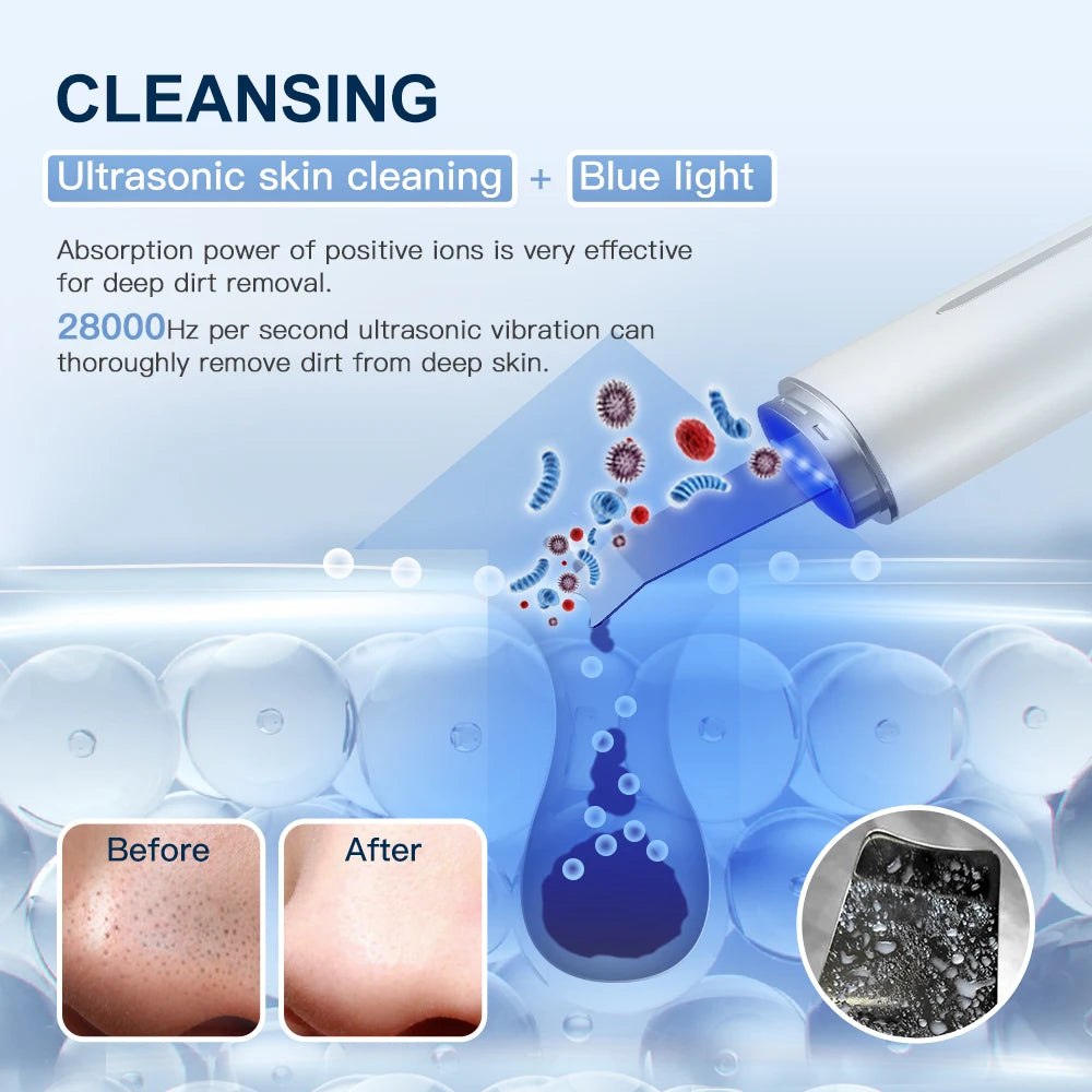 Ultrasonic Skin Scrubber - Face Cleaner Peeling Machine