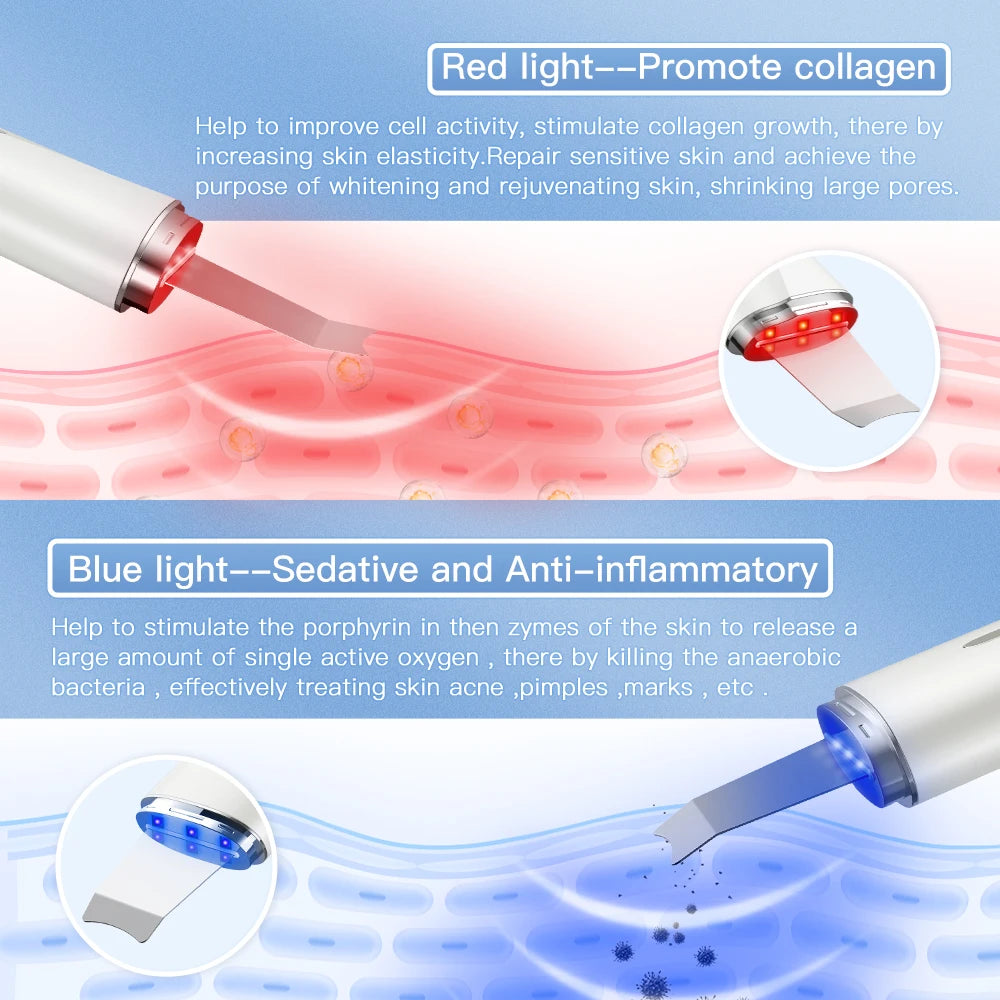 Ultrasonic Skin Scrubber - Face Cleaner Peeling Machine